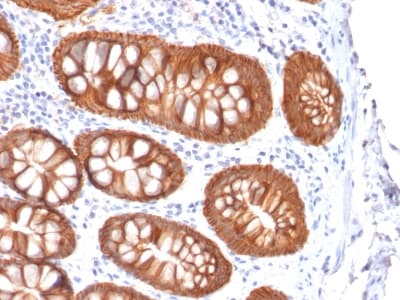 Recombinant Monoclonal Mouse anti-Human EPCAM Antibody (clone rVU-1D9, Azide-free,Carrier-free, IHC)
