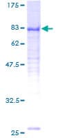 Human DDX25 Protein (Recombinant GST)