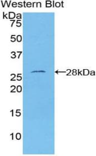 FOXO1 / FKHR Antibody (aa333-557, Biotin)