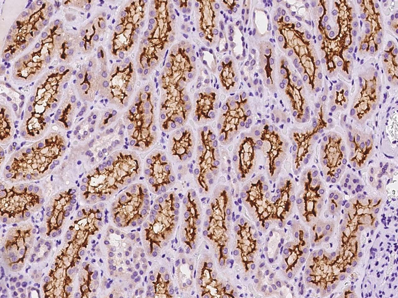 SLC5A12 Antibody