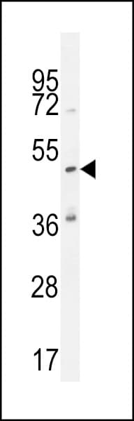 KATNAL1 Antibody (aa137-166)