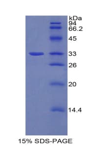 Rat AHR Protein (Recombinant His)