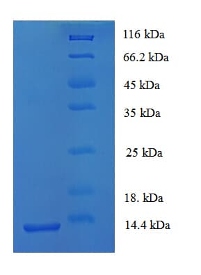 Mouse BRAK / CXCL14 Protein (Recombinant His)