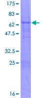 Human HOXD1 Protein (Recombinant GST)