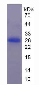 Mouse CSF1R / CD115 / FMS Protein (Recombinant His)