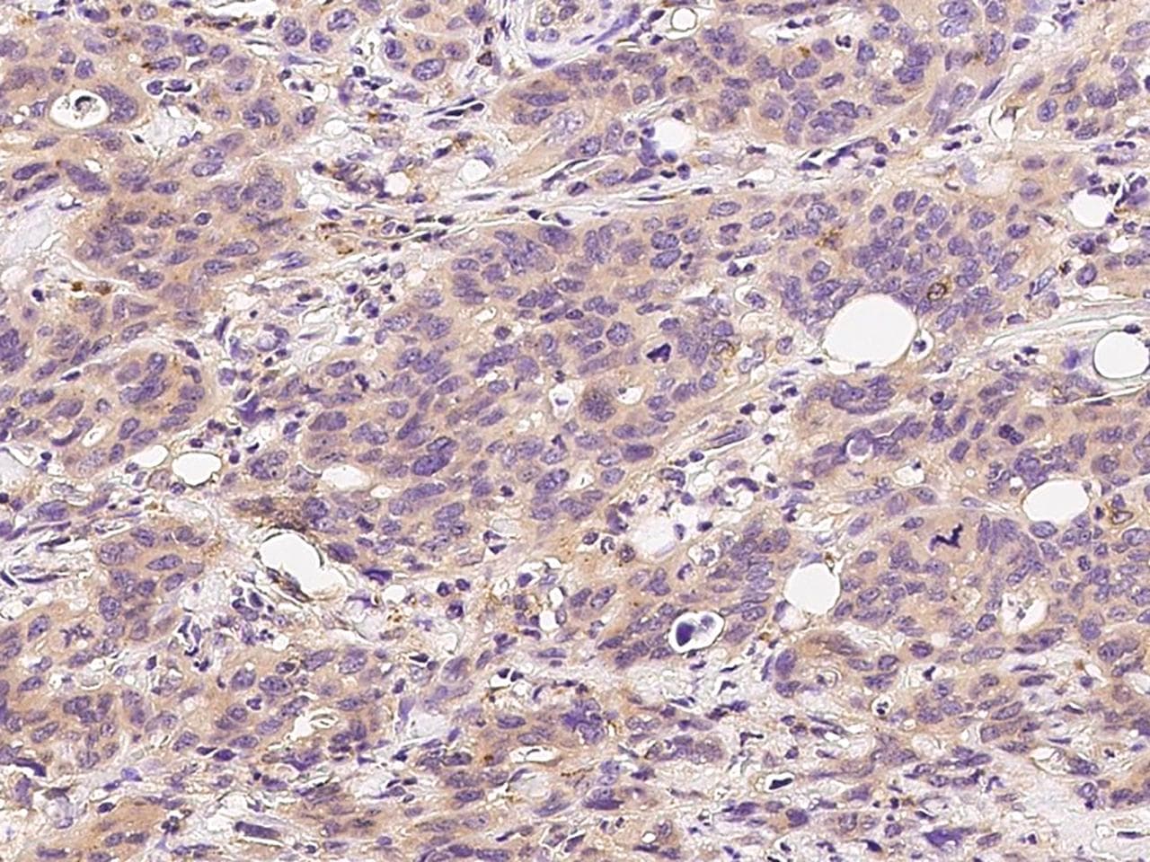 CETN1 Antibody (Preservative Free)