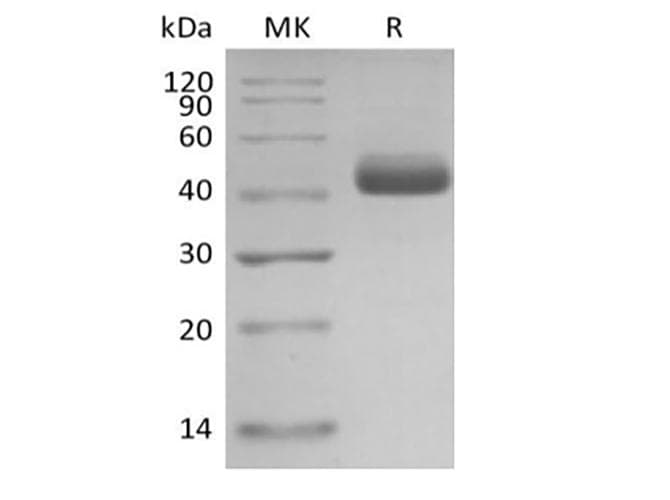 Human IL5 Protein (Recombinant Mouse IgG Fc, C-terminus)