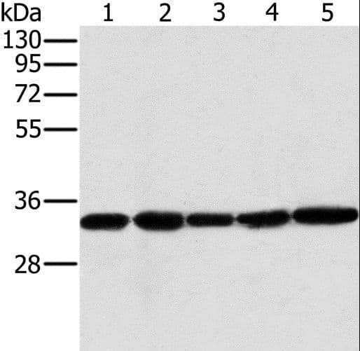 MTCH2 Antibody