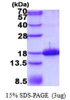 Human TAC1 Protein (Recombinant His)