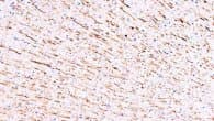 MAP1 Antibody (clone MP-1, Magnetic beads)