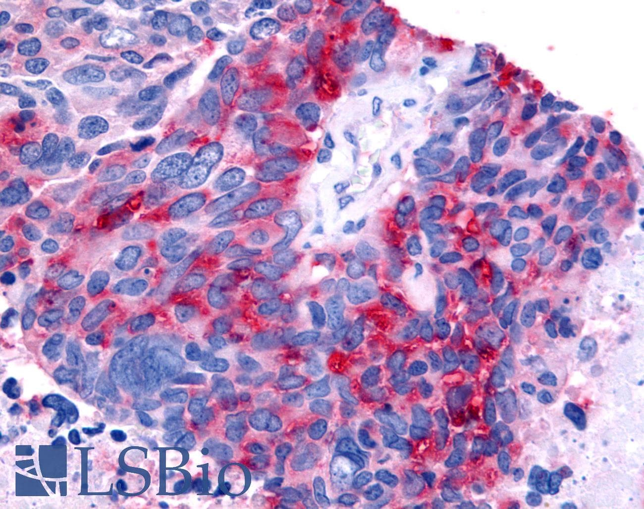 PathPlus™ Polyclonal Rabbit anti-Human RORB / ROR Beta Antibody (Ligand-binding Domain, IHC)