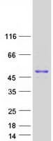 Human GNAS Protein (Recombinant Myc-DDK (Flag))