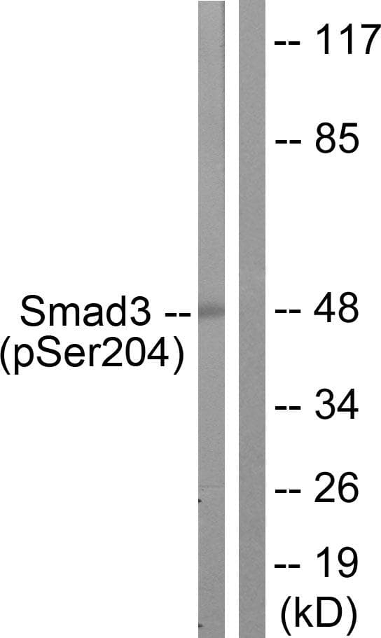 SMAD3 Antibody (phospho-Ser204)