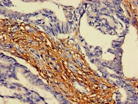 ARAP3 Antibody
