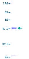 Human CBX3 / HP1 Gamma Protein (Recombinant GST)