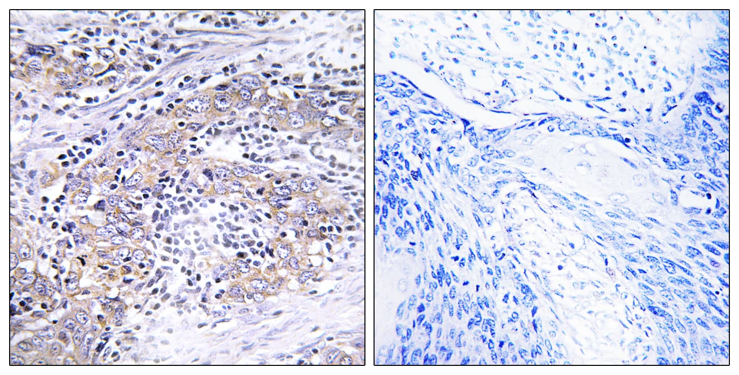 CLN6 Antibody (aa221-270)