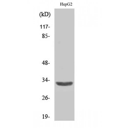 Polyclonal Rabbit anti-Human SLC25A6 / ANT3 Antibody (90-170 aa, Internal, IHC, WB)