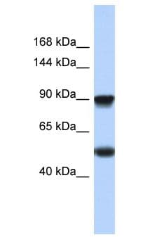 Polyclonal Rabbit anti-Human SCN8A / Nav1.6 Antibody (aa360-409, WB)
