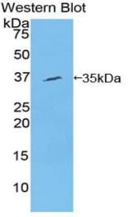 SYK Antibody (aa340-607, PE)