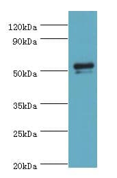 GC / Vitamin D-Binding Protein Antibody (aa305-474)