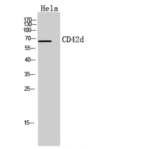 Polyclonal Rabbit anti-Human GPV / CD42d Antibody (331-380 aa, Internal, IHC, WB)