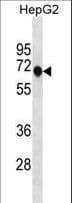 ANKDD1A Antibody (aa382-410)