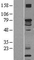Human KLC2 Protein (Over-Expression Lysate Myc-DDK (Flag))