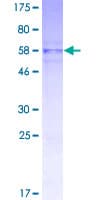 Human PIP4K2B Protein (Recombinant GST)