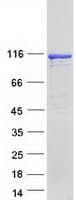 Human PRKD2 / PKD2 Protein (Recombinant Myc-DDK (Flag))