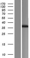 FBG4 / FBXO17 Protein (Over-Expression Lysate Myc-DDK (Flag))