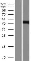ZDHHC7 Protein (Over-Expression Lysate Myc-DDK (Flag))