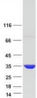 Human CUTC Protein (Recombinant Myc-DDK (Flag))