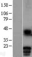 Human MD-1 / LY86 Protein (Over-Expression Lysate Myc-DDK (Flag))