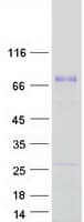 Human ACBD5 Protein (Recombinant Myc-DDK (Flag))