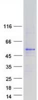Human Junctin / ASPH Protein (Recombinant Myc-DDK (Flag))