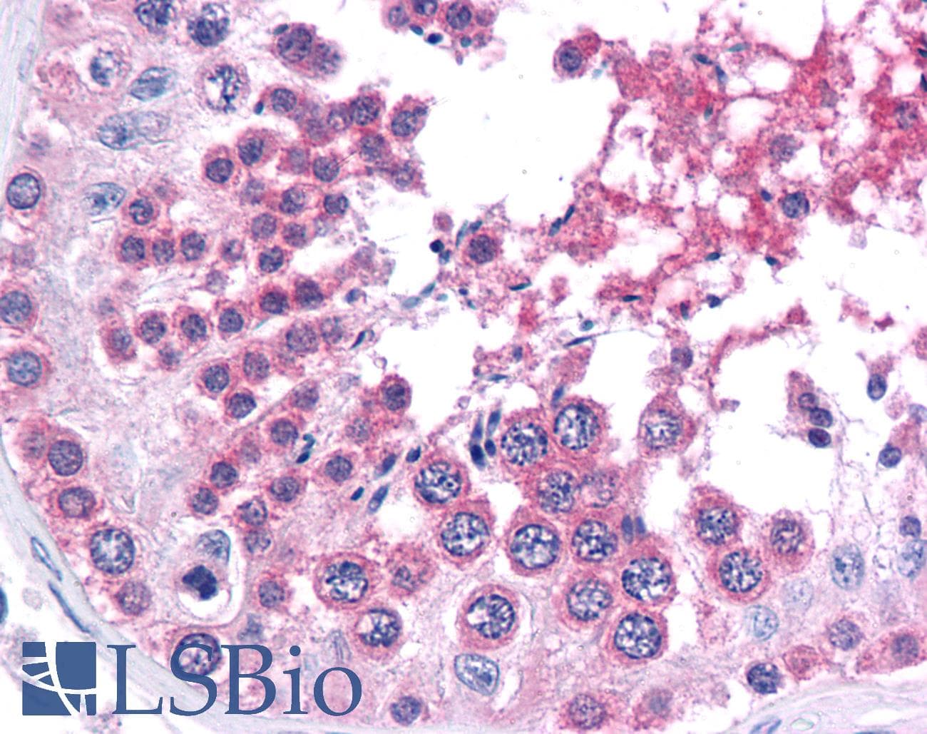 PathPlus™ SMARCA4 / BRG1 Antibody (C-Terminus, clone BRG-01)