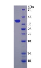 Human CAPN9 / Calpain 9 Protein (Recombinant His-T7, N-terminus)