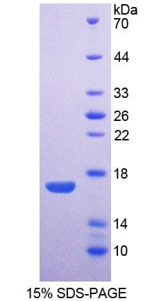 Rabbit AQP1 / Aquaporin 1 Protein (Recombinant His-T7)