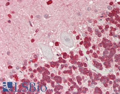 IHC-plus™ Polyclonal Rabbit anti-Human TALDO1 / Transaldolase 1 Antibody (aa200-250, IHC, WB)