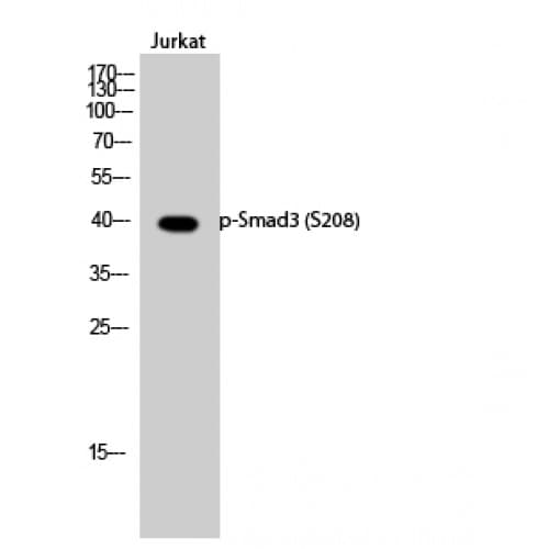 Polyclonal Rabbit anti-Human SMAD3 Antibody (150-230 aa, IHC, WB)