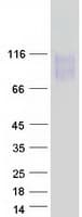 Human LAMP2 / CD107b Protein (Recombinant Myc-DDK (Flag))
