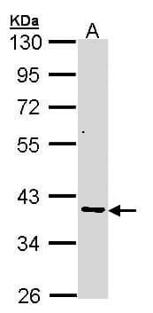 AKR7A2 / AFAR Antibody (aa84-359)