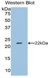 DUSP3 / VHR Antibody (aa2-185)