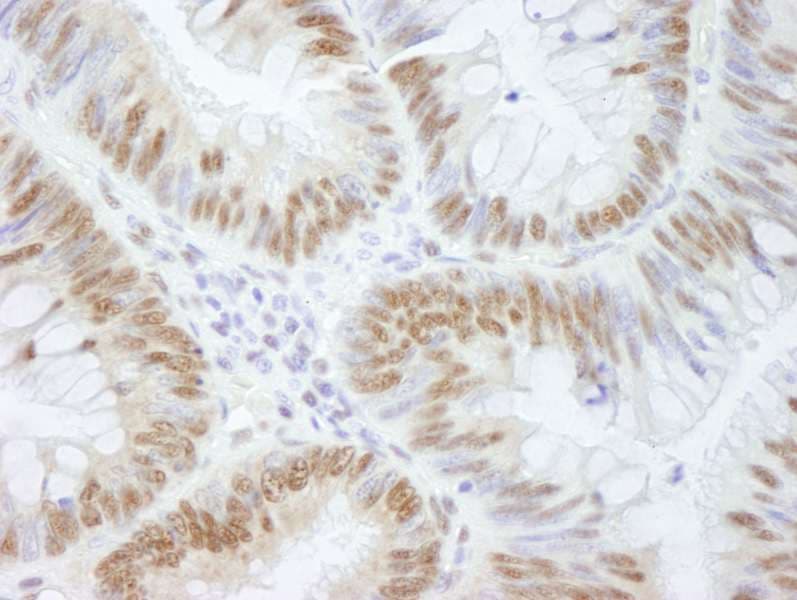 AKAP8 / AKAP95 Antibody (aa642-C-term)