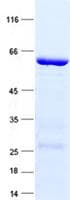Human HOXD1 Protein (Recombinant GST, N-terminus + His, C-terminus)