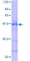 Human RPL9 / Ribosomal Protein L9 (Recombinant GST)