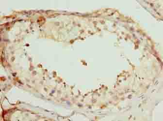 Polyclonal Rabbit anti-Human SCAPER Antibody (IHC)