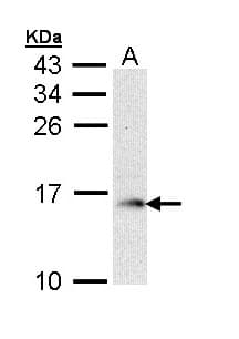 GMF Beta / GMFB Antibody (aa1-142)