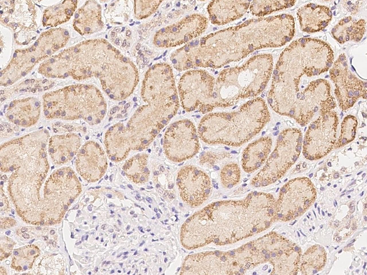 Polyclonal Rabbit anti-Human ATAD4 Antibody (IHC)