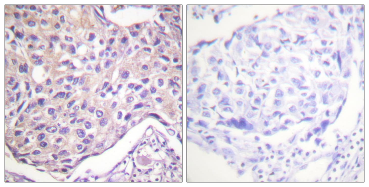 ADRBK1 / GRK2 Antibody (phospho-Ser29)